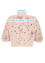 Load image into Gallery viewer, ItchClear® Spray | Prescription strength itch relief