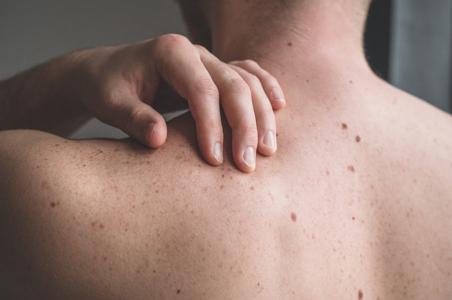 8 Surprising Factors That Increase Skin Cancer Risk